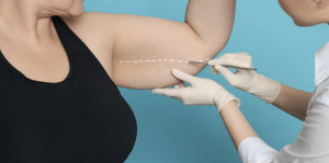 Free Liposuction Pricing Evaluations in McLean VA